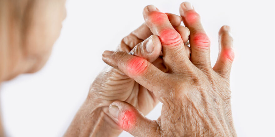 Rheumatoid Arthritis Joint Pain