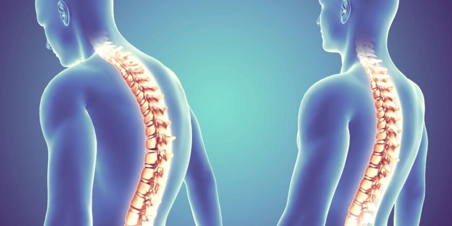 Spinal Conditions