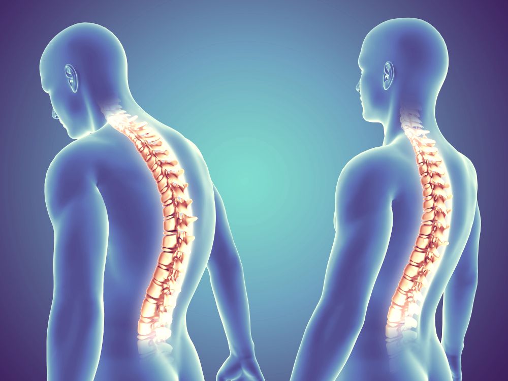 Spinal Conditions