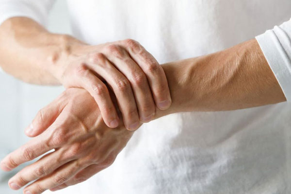 What is Rheumatoid Arthritis mbst
