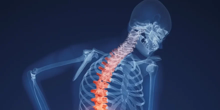 Family guide to osteoporosis